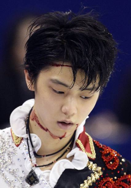 Il viso sanguinante di Yuzuru Hanyu. AP